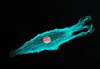 Dabrafenib Plus Trametinib Continue to Show Survival Benefit in BRAF-mutant Metastatic Melanoma Dabrafenib Plus Trametinib Continue to Show Survival Benefit in BRAF-mutant Metastatic Melanoma