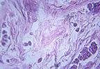 Integrating Texture Features in Breast Tissue Analysis Improved Accuracy of Tissue Classification Integrating Texture Features in Breast Tissue Analysis Improved Accuracy of Tissue Classification
