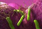 Eradication of Infection Improves Outcomes for <i>H Pylori+</i> patients with ITP Eradication of Infection Improves Outcomes for <i>H Pylori+</i> patients with ITP