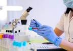 Noninvasive 2-Gene Test Helps Distinguish Melanoma From Nonmelanoma Noninvasive 2-Gene Test Helps Distinguish Melanoma From Nonmelanoma