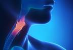 Metabolic Syndrome Associated With Increased Risk of Esophageal Cancer in Older Patients Metabolic Syndrome Associated With Increased Risk of Esophageal Cancer in Older Patients