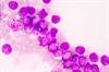 Risk of Therapy-Related MDS, AML Increased by Use of Leukemogenic Chemotherapy Agents Risk of Therapy-Related MDS, AML Increased by Use of Leukemogenic Chemotherapy Agents