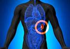 Pacritinib More Effective at Spleen Volume Reduction Than Best Available Therapy in Myelofibrosis Pacritinib More Effective at Spleen Volume Reduction Than Best Available Therapy in Myelofibrosis