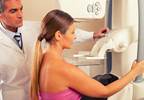 Starting Screening Mammography at Age 40 Leads to Greatest Mortality Benefit Starting Screening Mammography at Age 40 Leads to Greatest Mortality Benefit