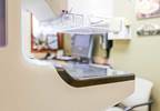 Breast Tomosynthesis Technique May Help Reduce Breast Cancer Screening Recall Rate Breast Tomosynthesis Technique May Help Reduce Breast Cancer Screening Recall Rate