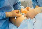 Regional Chemotherapy Technique May Help Prevent Amputations Regional Chemotherapy Technique May Help Prevent Amputations
