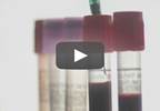 Novel Blood Test Pinpoints Cancer Without Invasive Procedures Novel Blood Test Pinpoints Cancer Without Invasive Procedures