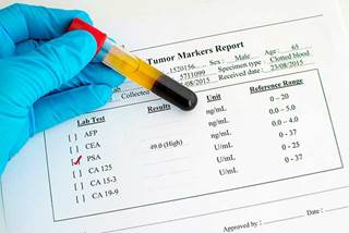 Previous studies have demonstrated mixed results in risk vs benefit of overdetection. Previous studies have demonstrated mixed results in risk vs benefit of overdetection.