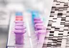 Bridging the Gap in Genetic Cancer Research Data on Minority Populations Bridging the Gap in Genetic Cancer Research Data on Minority Populations