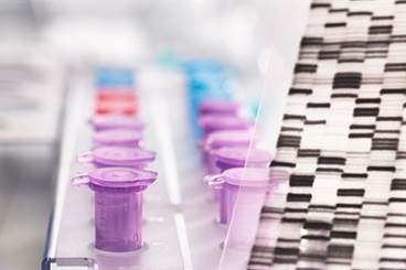 Benefit of Chemotherapy for Breast Cancer Observed With Midrange Gene Assay Score Benefit of Chemotherapy for Breast Cancer Observed With Midrange Gene Assay Score