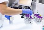 Value of Type and Crossmatch Prior to Daratumumab Administration Value of Type and Crossmatch Prior to Daratumumab Administration