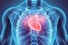 Carfilzomib Benefits May Outweigh Cardiovascular Risk in Multiple Myeloma Carfilzomib Benefits May Outweigh Cardiovascular Risk in Multiple Myeloma