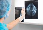 Breast Reconstruction Following Mastectomy (Fact Sheet) Breast Reconstruction Following Mastectomy (Fact Sheet)