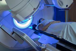 Radiotherapy for breast cancer Radiotherapy for breast cancer