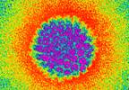 HPV and Cancer (Fact Sheet) HPV and Cancer (Fact Sheet)