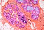 Dietary Estrogens Reduced Efficacy of Novel Breast Cancer Therapy Dietary Estrogens Reduced Efficacy of Novel Breast Cancer Therapy