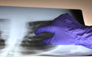 Using risk models may further complicate the screening process, experts have cautioned. Using risk models may further complicate the screening process, experts have cautioned.