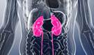 Tumor Lysis Syndrome, Renal Failure Complicate Elotuzumab Therapy for Multiple Myeloma Tumor Lysis Syndrome, Renal Failure Complicate Elotuzumab Therapy for Multiple Myeloma