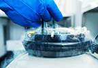 Inpatient Sperm Banking Shortens Time to Fertility Consultation Before Cancer Treatment Inpatient Sperm Banking Shortens Time to Fertility Consultation Before Cancer Treatment
