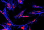 SD-101 May Enhance the Effectiveness of Immunotherapy in Melanoma SD-101 May Enhance the Effectiveness of Immunotherapy in Melanoma