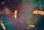 Ciprofloxacin Plus Doxycycline Reduces Infection Rate in Multiple Myeloma Post-ASCT Ciprofloxacin Plus Doxycycline Reduces Infection Rate in Multiple Myeloma Post-ASCT