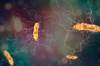Metronidazole, Vancomycin Recommended for <i>C Difficile</i> in Pediatric Oncology, HSCT Metronidazole, Vancomycin Recommended for <i>C Difficile</i> in Pediatric Oncology, HSCT