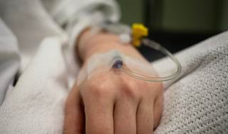Secondary analysis of data compared chemoradiotherapy outcomes in stage I-II vs stage III disease. Secondary analysis of data compared chemoradiotherapy outcomes in stage I-II vs stage III disease.