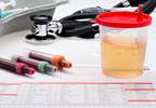 USPSTF: Decision to Undergo PSA Screening Should Be Individual USPSTF: Decision to Undergo PSA Screening Should Be Individual