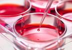 No Negative Effects on HRQOL With Post-ASCT Maintenance Therapy for Multiple Myeloma No Negative Effects on HRQOL With Post-ASCT Maintenance Therapy for Multiple Myeloma