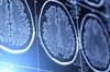 CNS Tumors in Childhood: Predicting Successful Independence in Adult Life CNS Tumors in Childhood: Predicting Successful Independence in Adult Life