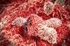 Assessment Tool for Immunotherapy Side Effects Assessment Tool for Immunotherapy Side Effects