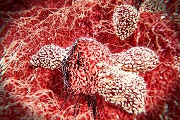 Assessment Tool for Immunotherapy Side Effects Assessment Tool for Immunotherapy Side Effects