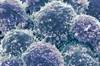 Use of Corticosteroids With PD-1 or PD-L1 Inhibitors Associated With Poorer Outcomes in NSCLC Use of Corticosteroids With PD-1 or PD-L1 Inhibitors Associated With Poorer Outcomes in NSCLC
