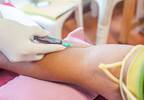 Recommended Therapies for Polycythemia Vera Underused Recommended Therapies for Polycythemia Vera Underused