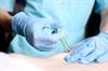 Substitute for Lidocaine Substitute for Lidocaine