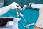 Shorter Duration of Cryotherapy as Effective as Standard Therapy Prior to HSCT for Multiple Myeloma Shorter Duration of Cryotherapy as Effective as Standard Therapy Prior to HSCT for Multiple Myeloma